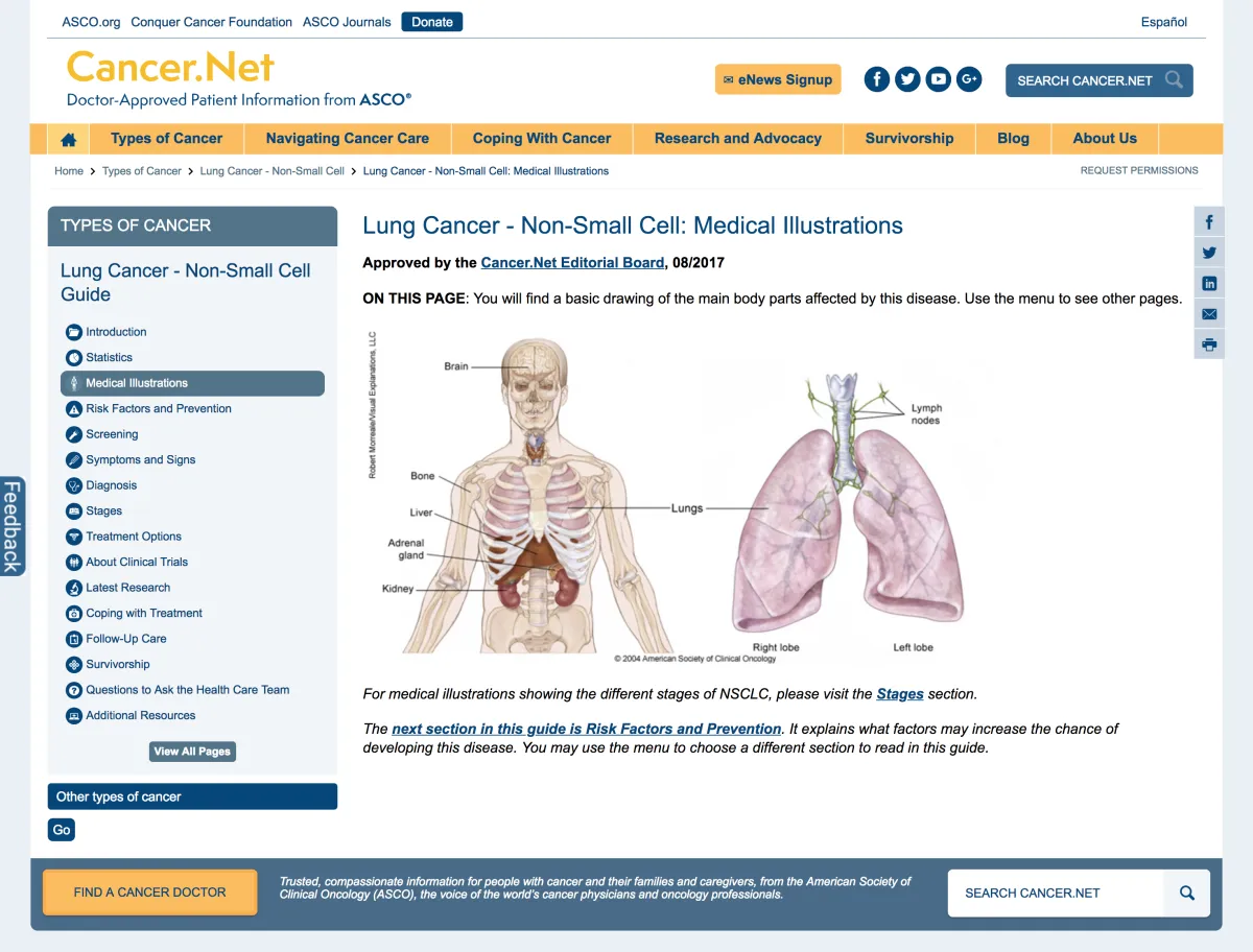 Cancer.net medical illustrations